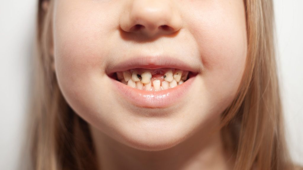 Le sourire de demain se construit aujourd'hui : comment brosser les dents de votre enfant dès le plus jeune âge ? 1